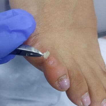 сколько стоит обучение на мастера маникюра: Коррекция вросших ногтей, Маникюр, Педикюр, Услуги подолога, Консультация, Одноразовые расходные материалы — 16