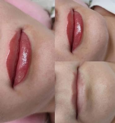 накладные брекеты для красоты купить: Акция! Акция!Акция! Перманентный макияж бровей, Теневая растушевка — 10