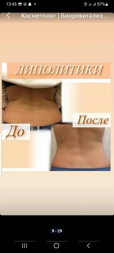 сколько стоит обучение на маникюр: Косметология, Биоревитализация, Ботулинотерапия, Сертифицированный косметолог, Гипоаллергенные материалы, Консультация — 4