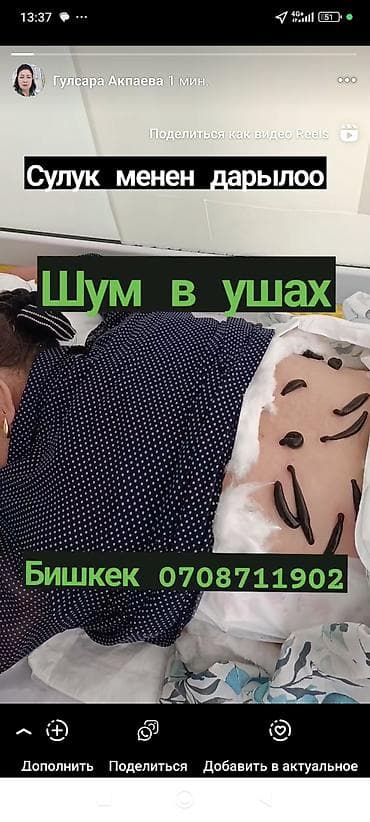 медицинские пиявки: Врачи | Гирудотерапевт | Лечение пиявками — 2