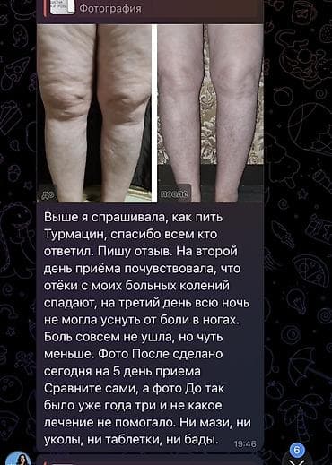 атоми паста отзывы: Селен, Для суставов и связок, Atomy/Атоми, Турмацин, Капсулы — 3