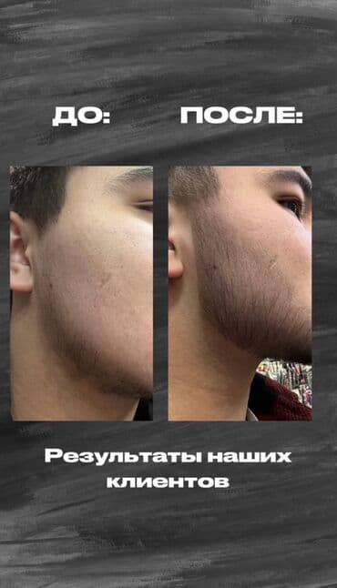 эко спрей от вшей как пользоваться: Сыворотка для роста волос и бороды RIJAL REAXIDIL 15% - Активный — 2