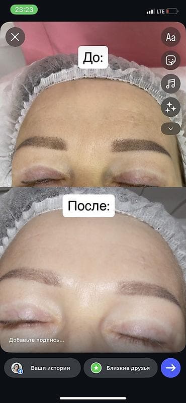 косметолог для мужчин: Косметология, Чистка кожи, Консультация — 8