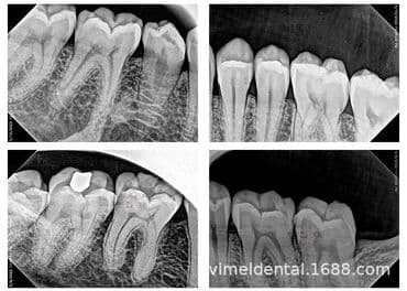 зуботехнические оборудование: Стоматологический рентгеновский аппарат Под заказ из Китая В наличии — 2