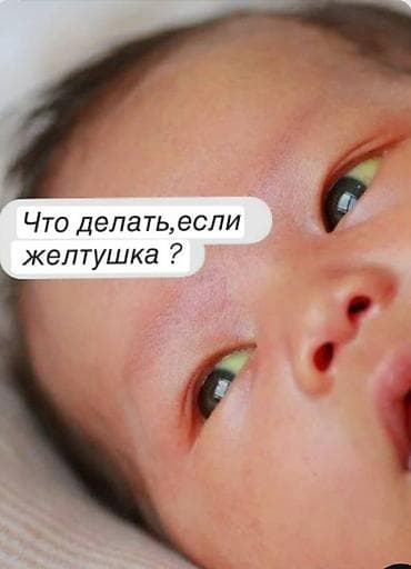 Медицинская одежда: Аренда фотолампы и билитеста для новорождённых (желтушка) - Фотолампа — 3