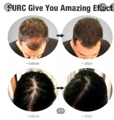 шампунь дисаар: Масло- эссенция PURE помогает предотвращать выпадение волос — 2