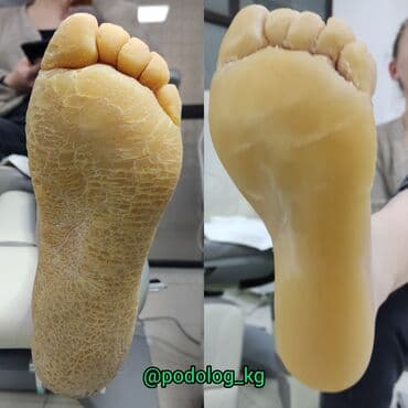 сколько стоит обучение на мастера маникюра: Коррекция вросших ногтей, Маникюр, Педикюр, Услуги подолога, Консультация — 12