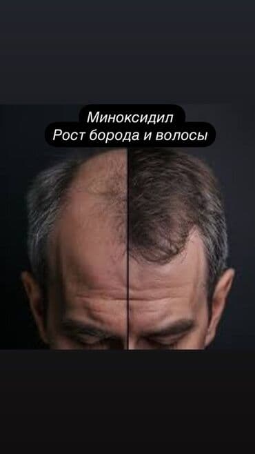 мужск: Миноксидил 5% для роста бороды + массажный дермароллер (указан как — 6