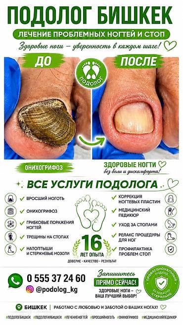 Коррекция вросших ногтей, Услуги подолога, Консультация — 1