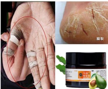 личный кабинет эрсаг кыргызстан: 🔥 Заживитель трещин . Шикарное средство — 1