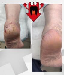 арендовать дом: Выравнивание, Услуги подолога, С выездом на дом, Консультация, Одноразовые расходные материалы — 10