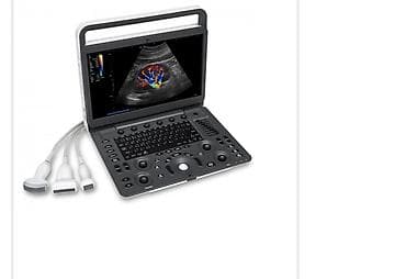 Инвалидные коляски: УЗИ SonoScape. Мобильный. 3 датчиками. Почти новый. Есть принтер и — 3