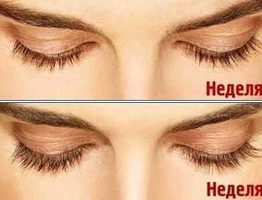 эко спрей от вшей как пользоваться: Карепрост (Careprost) - наиболее эффективный на сегодняшний день — 2