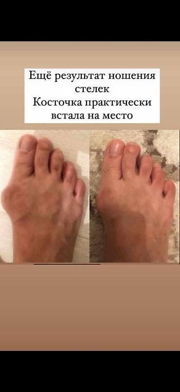 Медтовары: Ортопедические стельки Health Priority с анионами - Профессиональные — 3