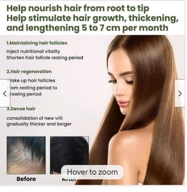 личный кабинет эрсаг кыргызстан: ❄️ С️ША Сыворотка для роста волос и бороды blusoms folligrow — 6