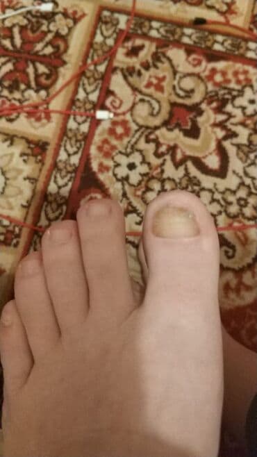 самый лучший эндокринолог рядом просп жибек жолу бишкек: Воосшие ногти, заболевания ногтей, стопы, бородавки, мозоли — 9