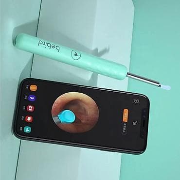 Умная ковырялка в ушах (ушной эндоскоп) от Xiaomi с камерой и