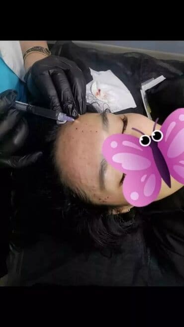 узи с выездом на дом бишкек: . Чистка лица, пилинги, инъекции красоты, ботокс, биоревитализация — 5