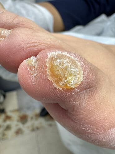 самый лучший эндокринолог рядом просп жибек жолу бишкек: Наращивание ногтей, Укрепление ногтей, Ремонт сломаных ногтей, Маникюр, Педикюр, С выездом на дом, Консультация, Одноразовые расходные материалы — 10