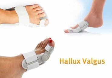 фиксатор для ног: Ортопедическая шина hallufix адрес: лермонтова — 6