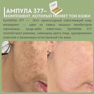 nike original: Ампулы для лица SymWhite 377 Ampoule (JUWAY) — осветляющая и — 5