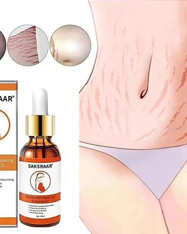 масло от растяжек: Эфирное масло для удаления растяжек до и после родов — 1