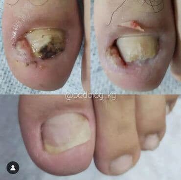 сколько стоит обучение на мастера маникюра: Выравнивание, Наращивание ногтей, Донаращивание ногтей, Маникюр, Педикюр, Услуги подолога, С выездом на дом, Консультация, Одноразовые расходные материалы — 3