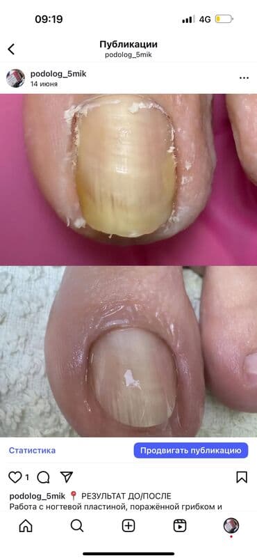 сколько стоит обучение на маникюр: Коррекция вросших ногтей, Услуги подолога, Консультация, Одноразовые расходные материалы — 1