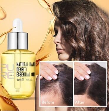 эко спрей от вшей как пользоваться: Натуральное эфирное масло для роста волос PURE. Экстракт имбиря — 3