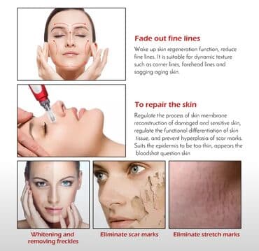 аппарат для прокол ушей: MYM Bayonet Derma pen, игольчатый картридж, устройство для — 1