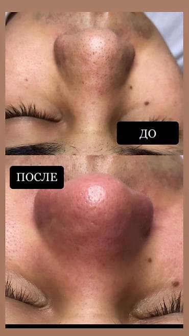 Окутуу, курстар: Курстар | Косметологдор жана визажисттер, Депиляция чеберлери Сертификат берилет, Сарпталуучу материалдар менен камсыздоо, Үлгүлөр менен камсыздоо — 6