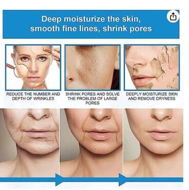 гиалуроновая кислота для суставов бишкек: ❄️ США Шоковое антивозрастное средство - гиалуроновая кислота — 8