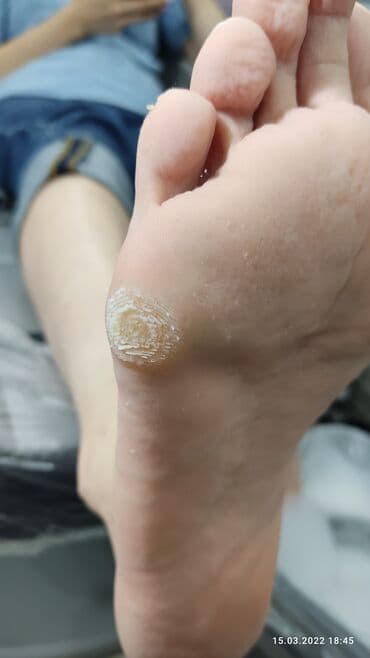 кресло барбер: Сынган тырмактарды оңдоо, Ичине кирип өскөн тырмактарды оңдоо, Педикюр, Консультация, Бир жолку сарпталуучу материалдар — 4