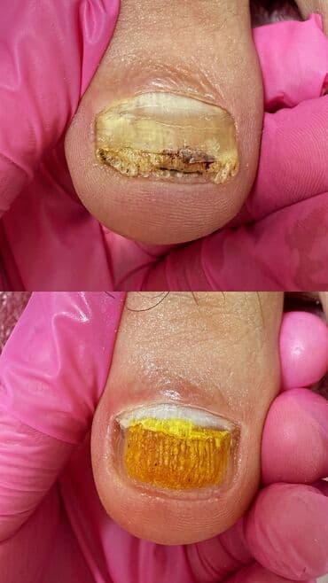 маникюр на дом бишкек: Выравнивание, Покрытие гель лаком, Коррекция вросших ногтей, Маникюр, Педикюр, Консультация, Требуются модели, Одноразовые расходные материалы — 1