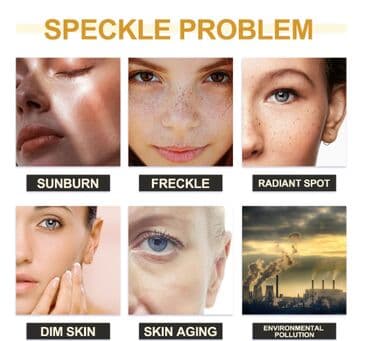 личный кабинет эрсаг кыргызстан: США Крем интенсивный отбеливающий антивозрастной Данный крем — 6