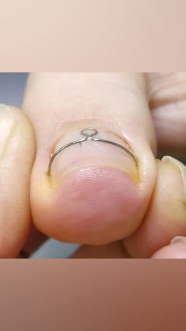 самый лучший эндокринолог рядом просп жибек жолу бишкек: Дизайн, Наращивание ногтей, Гель лак, шеллак, Маникюр, Педикюр, Услуги подолога, Консультация, Одноразовые расходные материалы — 2