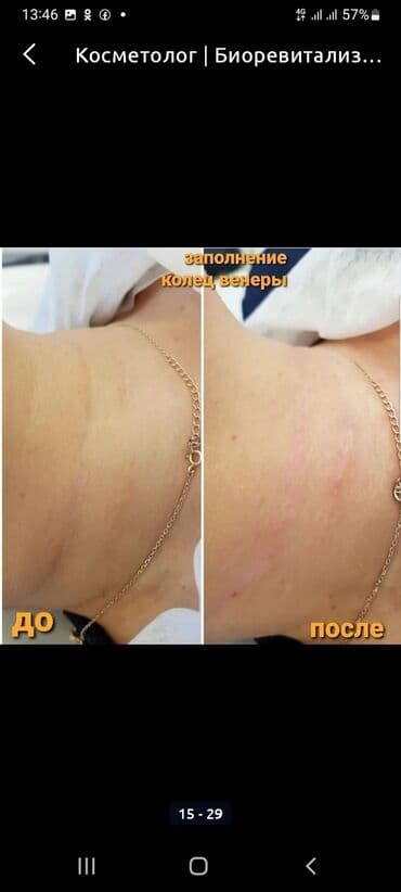 сколько стоит обучение на маникюр: Косметология, Биоревитализация, Ботулинотерапия, Сертифицированный косметолог, Гипоаллергенные материалы, Консультация — 13