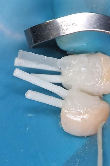 аренда стоматология: Стоматологическая услуга: реставрация передних зубов с применением — 3