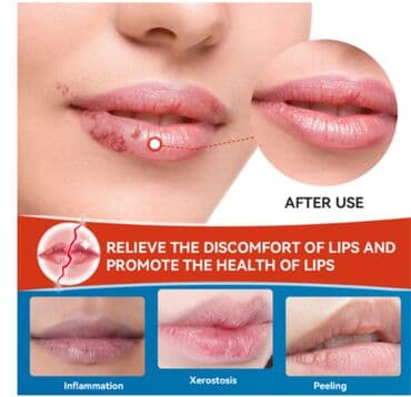 личный кабинет эрсаг кыргызстан: ❄️ Крем Герпес все интересующее на фото только звонки и — 5