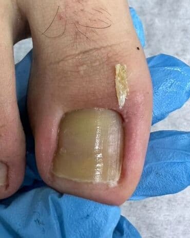 сколько стоит обучение на мастера маникюра: Выравнивание, Наращивание ногтей, Донаращивание ногтей, Маникюр, Педикюр, Услуги подолога, Консультация, Одноразовые расходные материалы — 8