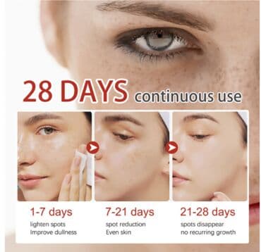 эффективный отбеливающий крем для зоны бикини в аптеке: США Крем отбеливающий для удаления мелазмы осветления кожи удаления — 2