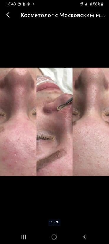 сколько стоит обучение на маникюр: Косметология, Биоревитализация, Ботулинотерапия, Сертифицированный косметолог, Гипоаллергенные материалы, Консультация — 7