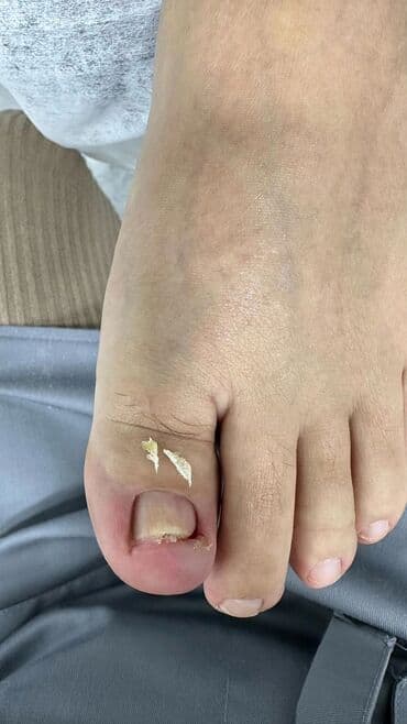 медсестра на дом бишкек мкр: Выравнивание, Наращивание ногтей, Донаращивание ногтей, Маникюр, Педикюр, Услуги подолога, С выездом на дом, Консультация, Одноразовые расходные материалы — 4