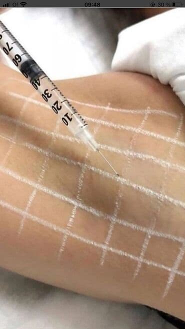 сколько стоит обучение на маникюр: Косметология, Биоревитализация, Ботулинотерапия, Сертифицированный косметолог, Гипоаллергенные материалы, Консультация — 28