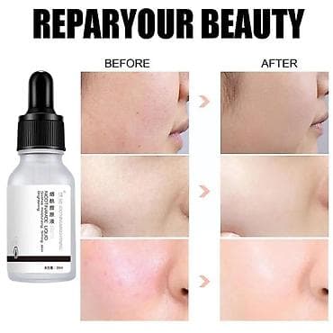 никотиновая кислота: Отбеливающая сыворотка Эффективность продукта: увлажняет и — 5