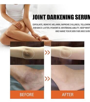 личный кабинет эрсаг кыргызстан: ❄️ США Отбеливать кожу - Масло семян папайи Осветлитель для кожи — 6