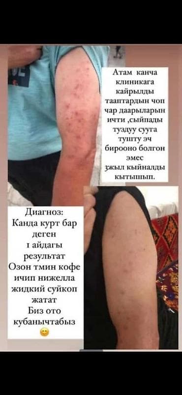 Красота и здоровье: Тминовый комплекс Newway для кожи: капсулы + кофе-микс Описание: - — 1