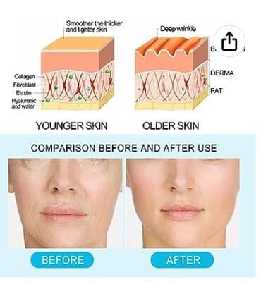 корейские капсулы день ночь отзывы: ❄️ США Антиоксидантная сыворотка против морщин, MMP Антиоксидантная — 3