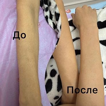 мастер эпиляции: Шугаринг в Бишкеке - Эпиляция сахарной пастой: деликатное удаление — 5