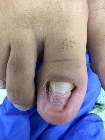 сколько стоит обучение на мастера маникюра: Коррекция вросших ногтей, Маникюр, Педикюр, Услуги подолога, Консультация, Одноразовые расходные материалы — 18